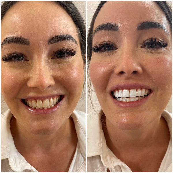 10,000+ Brighter Smiles